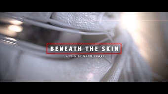 MadMicrobe: Beneath The Skin
