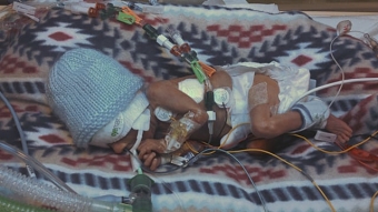 Action Medical Research - Jack's Story (NEC) - Short