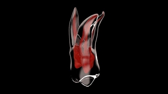 UpperMolar2_Dissolve