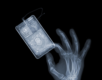 Banana Equivalent Dose: X-ray Art