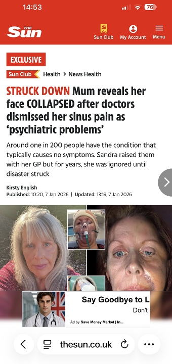 Pitched and wrote health piece for Sun Online UK