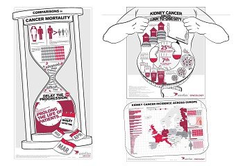Astellas Kidney Infographics