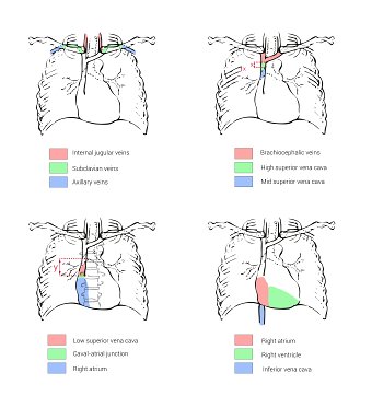 Medical illustration work: Anaesthesia & surgery