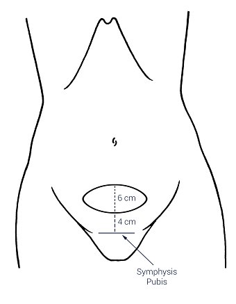 Medical illustration work: obstetrics