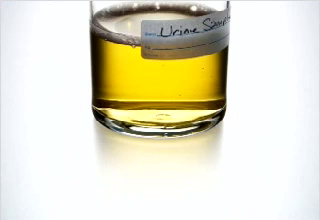 Drink Drive