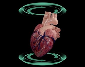 3D Product Placement Within a Human Heart
