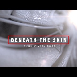 MadMicrobe: Beneath The Skin