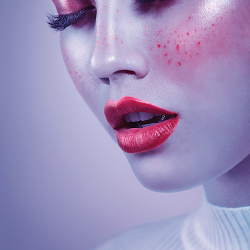 Freckles