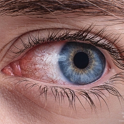Newclar -Red Eyes