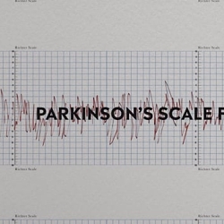 Parkinson´s Scale Films.mp4