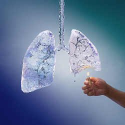 COPD Lungs