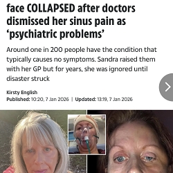 Pitched and wrote health piece for Sun Online UK