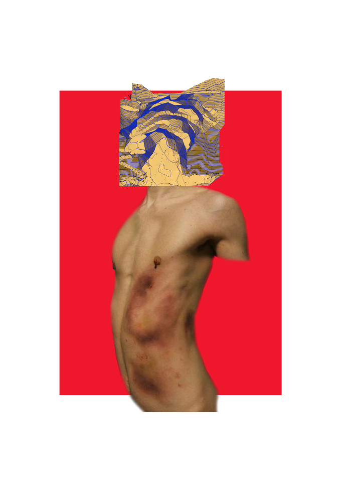 *