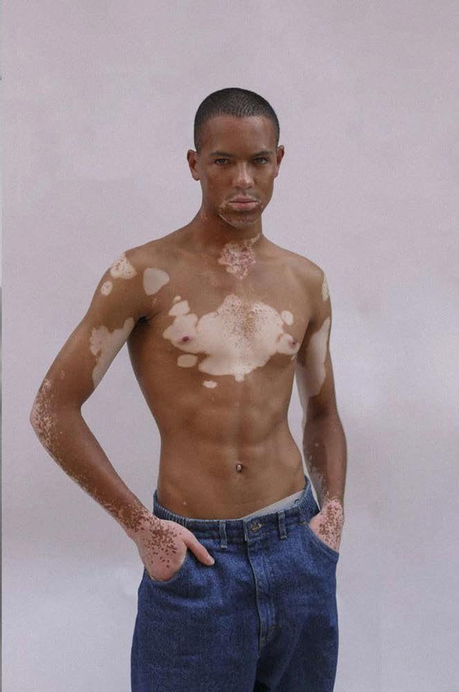 *