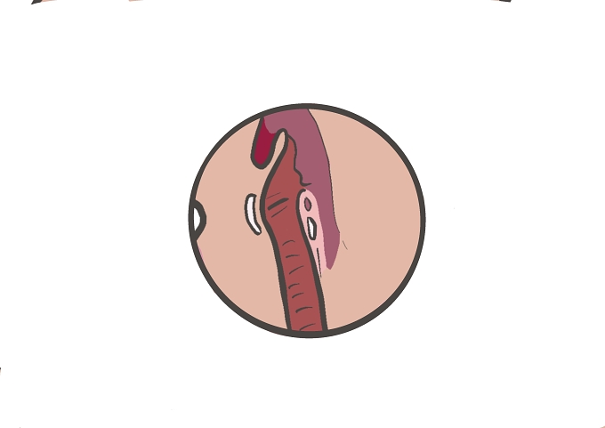 *