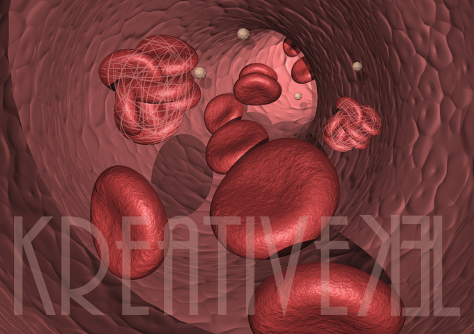 *