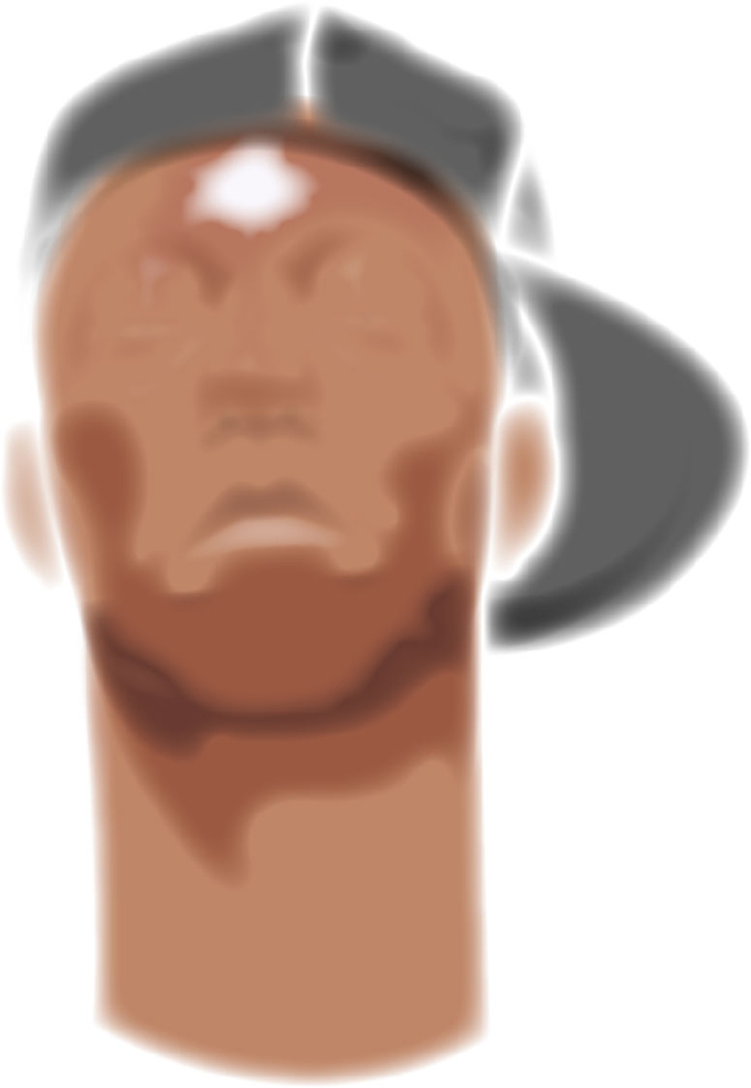 *