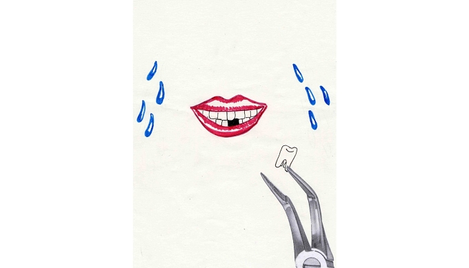 *