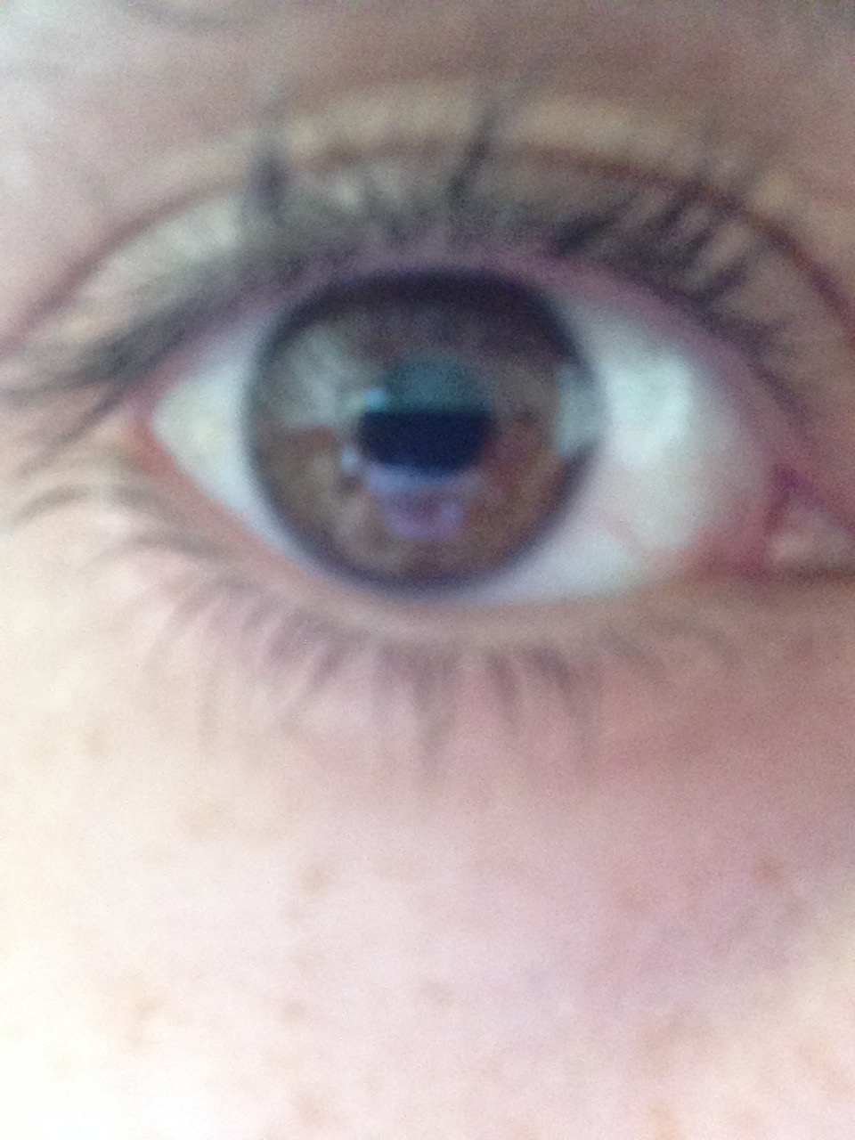 Right Eye