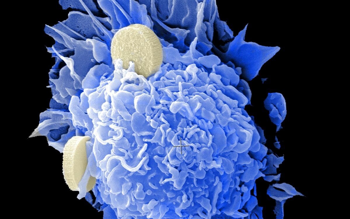 national-cancer-institute-gyGyIEeikSw-unsplash-resized