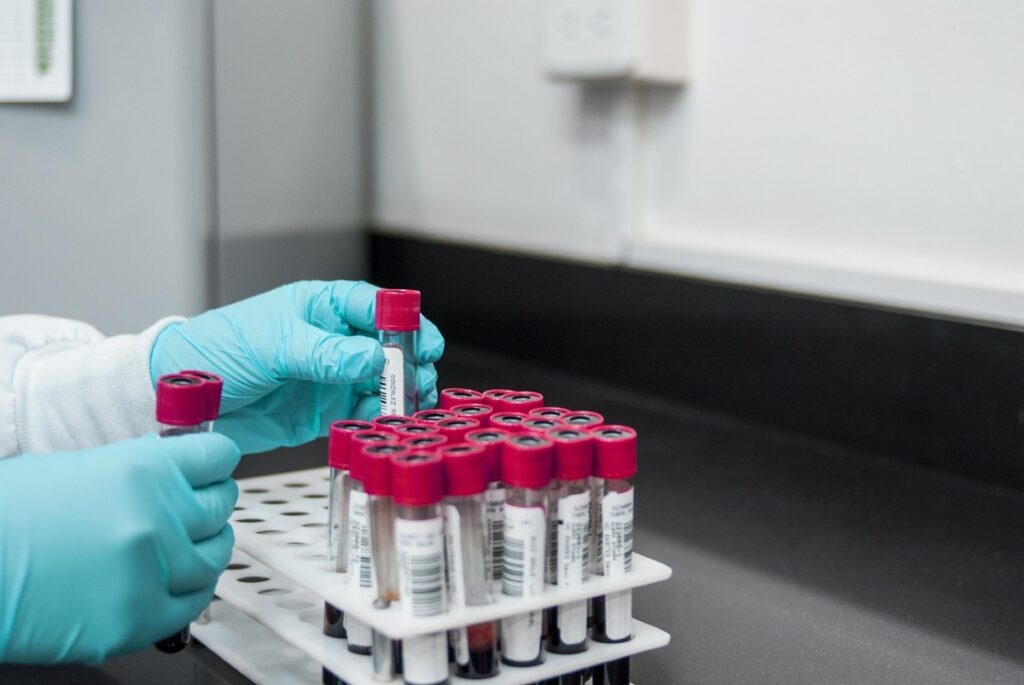 A researcher’s gloved hand holding a glass beaker containing a blue liquid, surrounded by laboratory glassware and test tubes on a clean lab bench, evoking a biochemistry or pharmaceutical research setting.