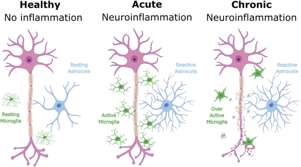 Figure 1. Cellular changes in response to varying degrees of inflammation. The figure illustrates the progression of neuroinflammation from a healthy state to acute and chronic inflammation.