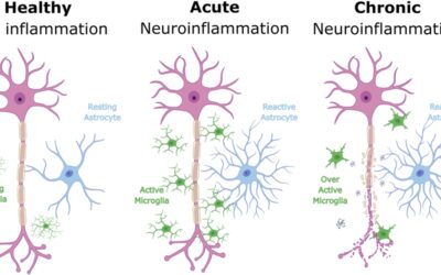 MRI Study Links Inflammation in Brain Reward Centre to Depression Severity