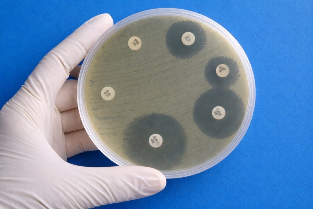 AMR susceptibility test: Bacteria showing resistance to Ceftazidime, Imipenem, and Ciprofloxacin in a lab culture.