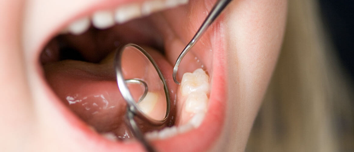 Dental Hygienist Insurance - Medical Indemnity