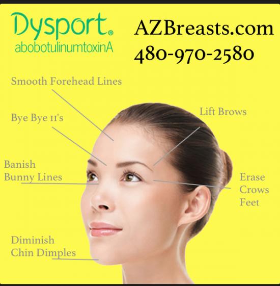 Dysport® injection specialists in Scottsdale - Gue