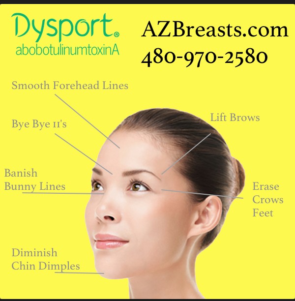 Dysport-injection-specialists-in-Scottsdale-Gue