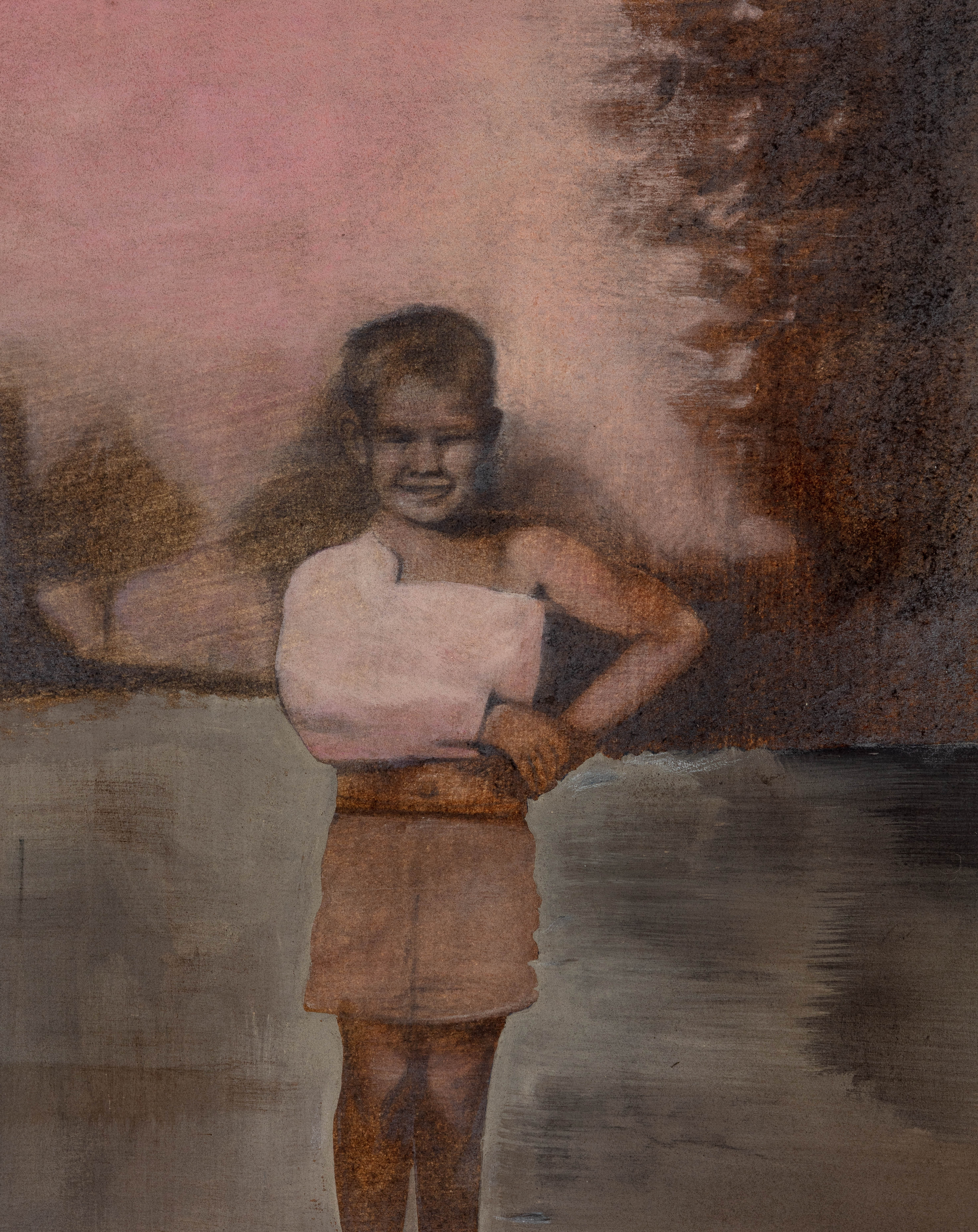 Photograph of Boy in Cast