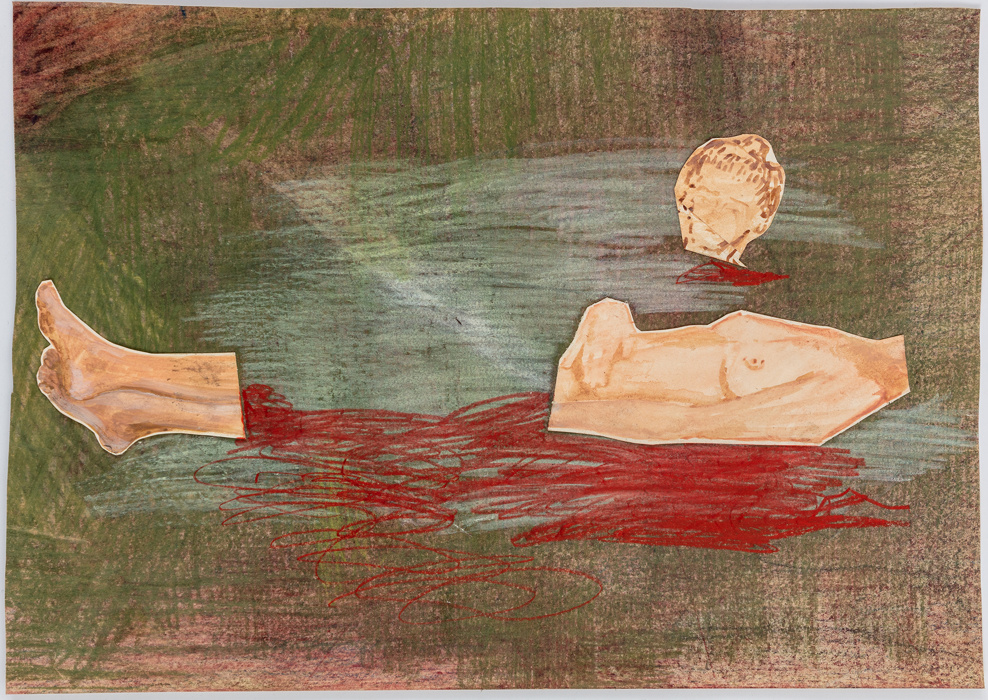 A not admitting of the wound until it grew so wide