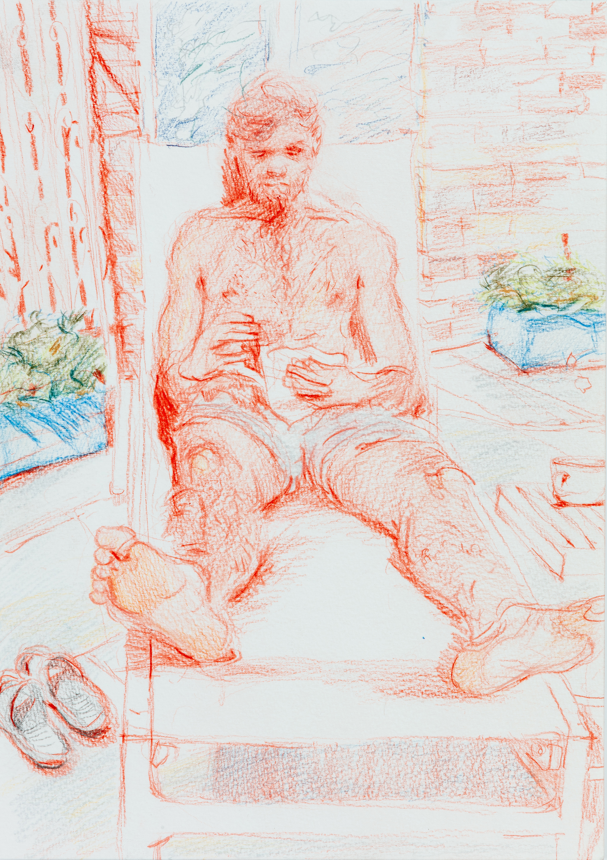 Sunburn