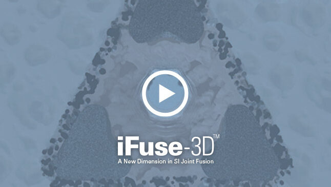 Ifuse 3d video cover