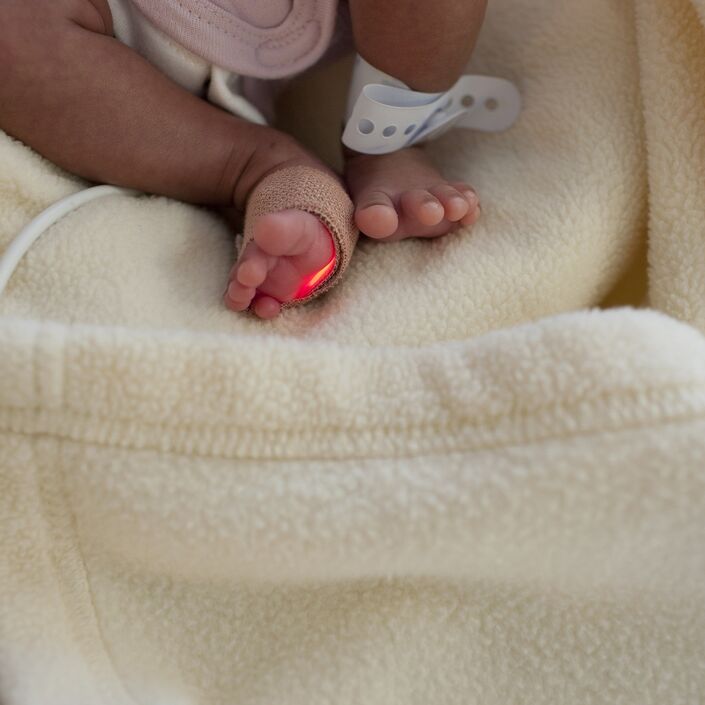 Picture of premature baby's legs attached to a medical instrument