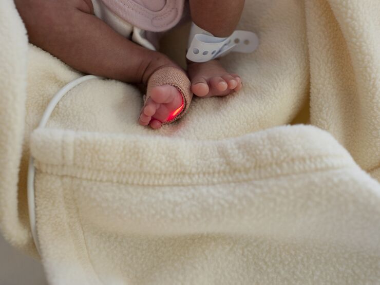 Picture of premature baby's legs attached to a medical instrument
