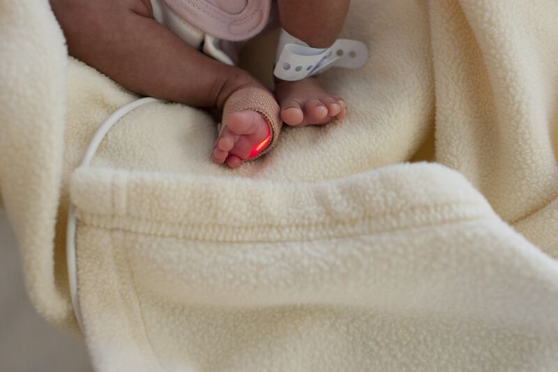 Picture of premature baby's legs attached to a medical instrument