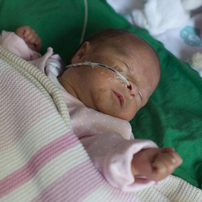 Baby asleep on its back being tube fed through its nose
