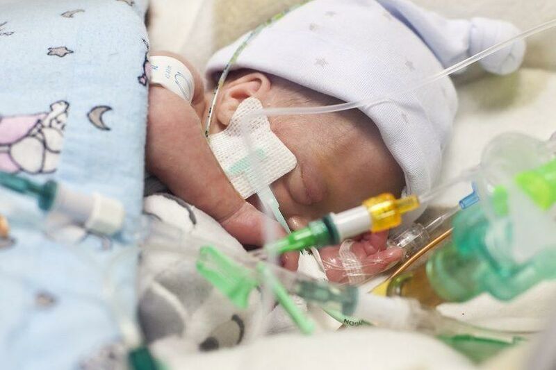 Premature baby wearing a wooly hat sleeping peacefully attached to several tubes