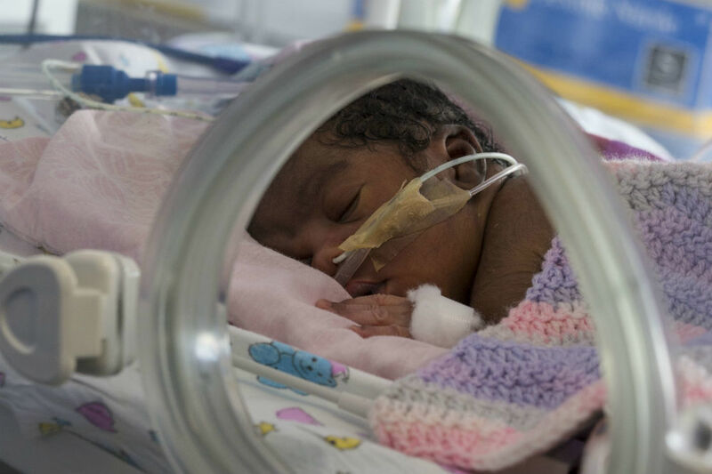 Baby covered in blanket attached to feeding tube sleeping peacefully in an incubator