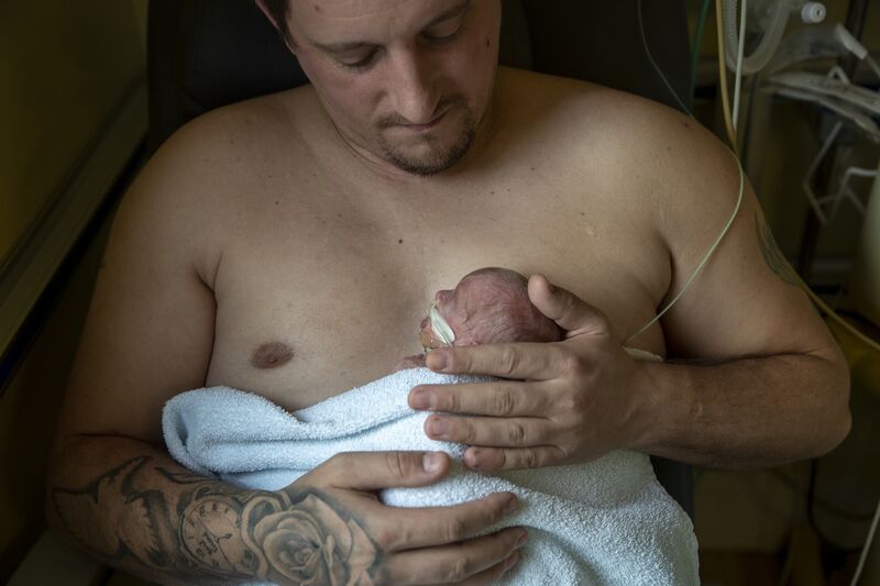 Dad doing skin-to-skin care with baby with a tube