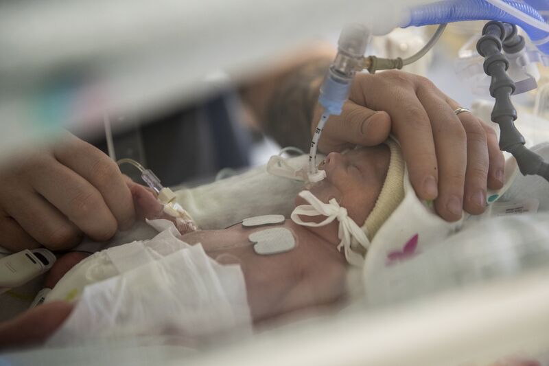 Baby attached to tubes being comforted by parent's hands