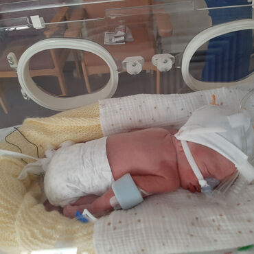 Elijah in incubator on oxygen