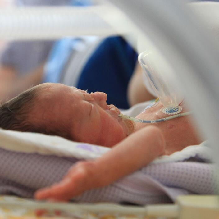 Baby in an incubator attached to tube sleeping