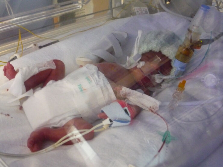 Charlie 0 Days Old 3