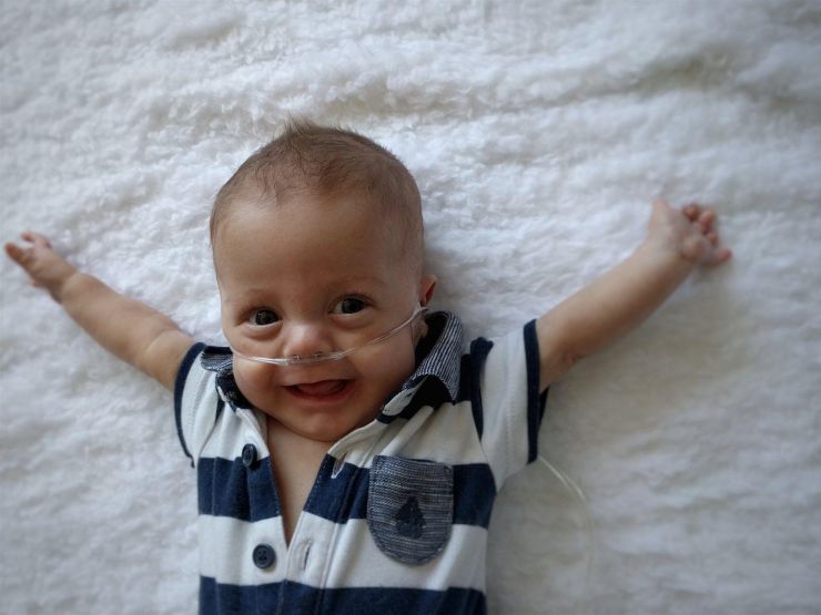 Baby attached to feeding tube lying down with arms outstretched and smiling