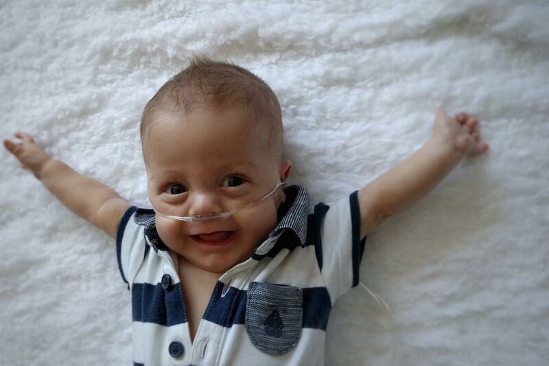 Baby attached to feeding tube lying down with arms outstretched and smiling