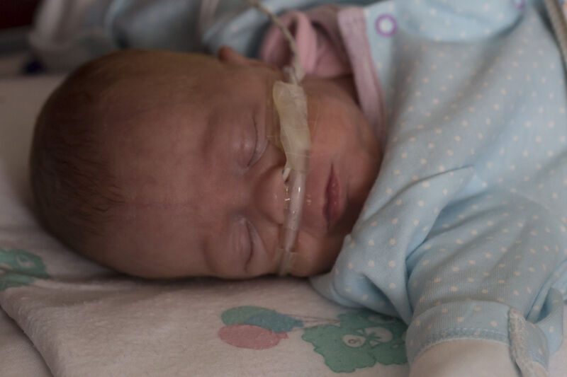 Baby in pyjamas sleeping peacefully with a tube attached to their nose