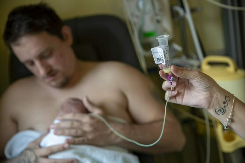 A father is sitting with his baby cuddling on his chest. The baby is receiving milk through a tube which is being held by his mother.
